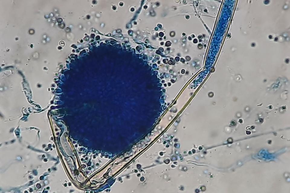 Microscope view of a round blue stained Aspergillus niger spore head on a long stalk with loose spores around it