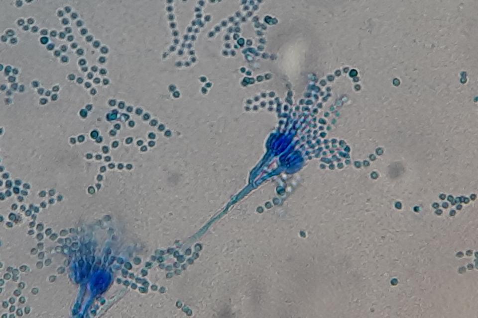 Microscope view of two blue stained Penicillium spore heads shaped like brushes, with chains of round spores